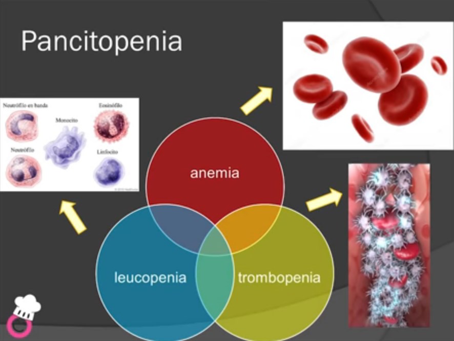 Hematología en un paciente celiaco por la Dra. Ana Arruga